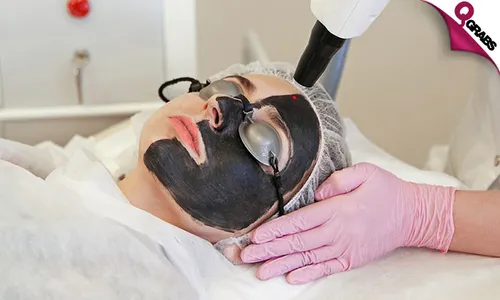 Carbon Laser Facial Treatment + Consultation!